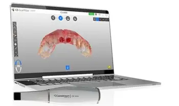Complete Set Intraoral Digital Handheld Scanner 3D Aoralscan 3 Dental +15' nešiojamas kompiuteris